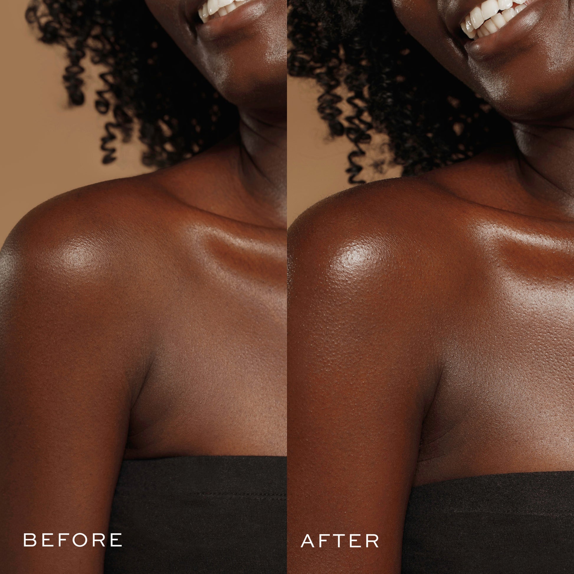 Boosting Body Serum Before & After
